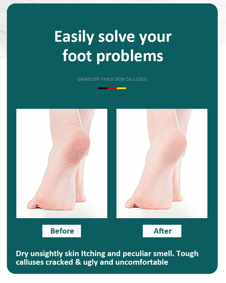 High-Quality Foot File Double Sided Callus Remover For Dead Skin Professional Pedicure Tools Callous Scraper Sander Heel Filer